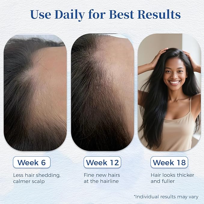 Hair Growth Serum Roll On with Rosemary，Helps Support Thicker, Fuller Hair Appearance，Clean, Non-Greasy Hair Loss Support for Men & Women，Rosemary，0.84 Fl Oz (Pack of 1)