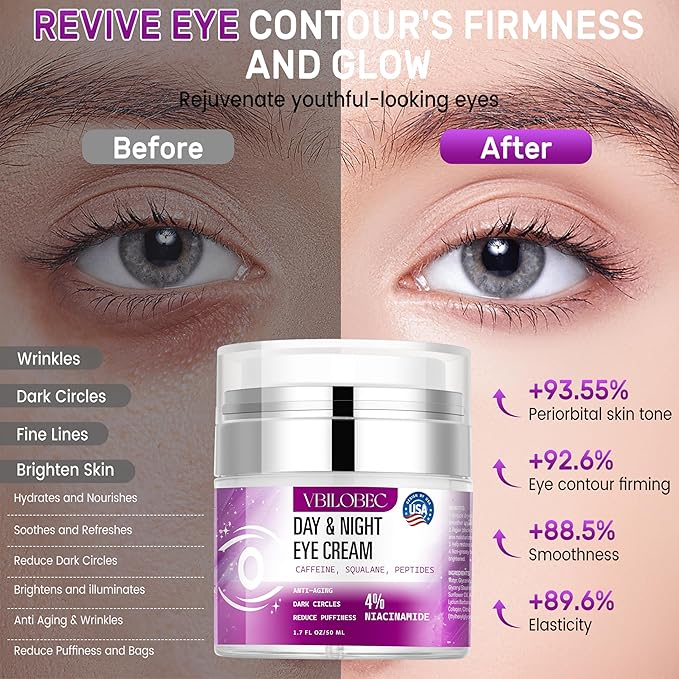 2025 Latest Caffeine Eye Cream:[30+ SGS Certified] [Used by Over 1M Fans] Anti-aging Eye Cream to eliminate dark circles, puffiness, and fine lines.1.7 fl oz, for Women& Men,3PC