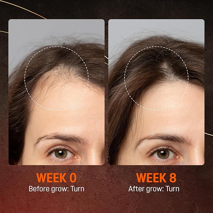 Abera Hair Growth Serum for Hair Loss, Natural Hair Regrowth Treatment for Hair & Beard with Biotin & Castor Oil | Extra Strength & Bigger Size 1.69 fl oz, (2 Serum + Gift)