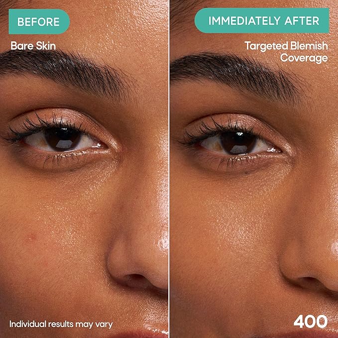 Almay Clear Complexion Concealer, Cruelty-Free Makeup for Acne-Prone Skin, Non-Comedogenic, Vegan, Hypoallergenic, 400, 0.3 fl oz