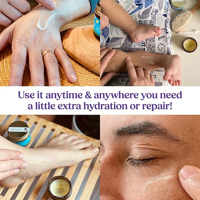 Organic Beef Tallow Bag Balm with Frankincense, Lavender, & Rosehip Oil, 1 oz – Hand Made in USA Tallow Moisturizer for Dry, Sensitive Skin, Rosacea, Eczema | Natural Hydration for Face & Body