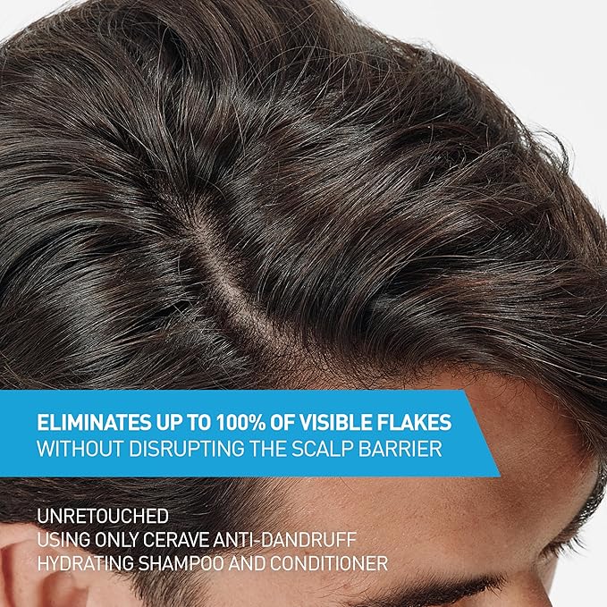 CeraVe Hydrating Anti Dandruff Shampoo and Conditioner Set, Pyrithione Zinc Dandruff Treatment With Ceramides, Hyaluronic Acid & Niacinamide, Elimanates Flakes & Reduces Itchy Scalp