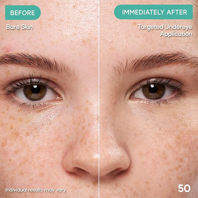 Almay Clear Complexion Concealer, Cruelty-Free Makeup for Acne-Prone Skin, Non-Comedogenic, Vegan, Hypoallergenic, 050, 0.3 fl oz