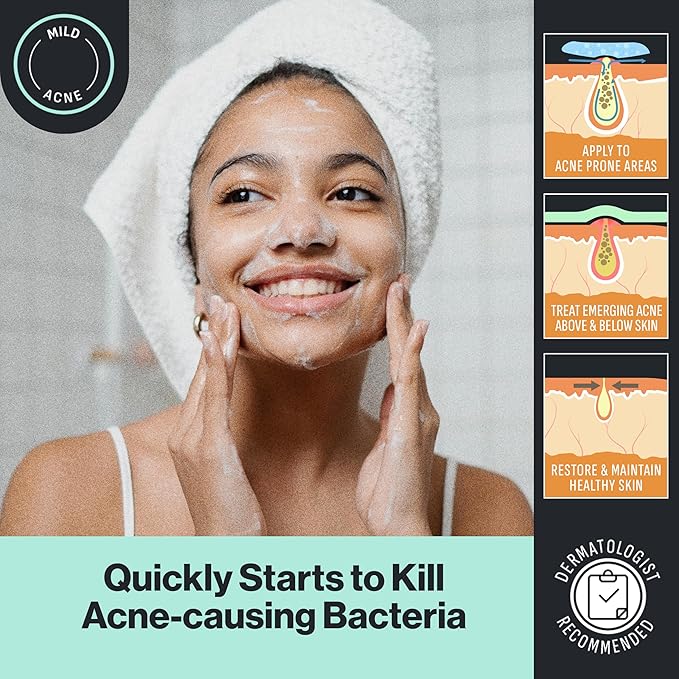 Oxy Sensitive Skin Acne Cream Cleanser (Pack of 2)