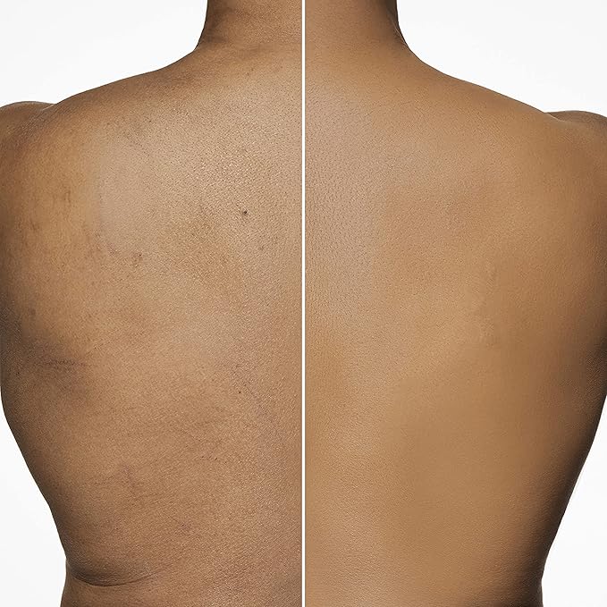 Dermablend Leg and Body Makeup Foundation with SPF 25, 10N Fair Ivory, 3.4 Fl. Oz.