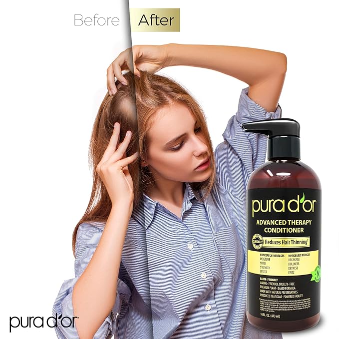 PURA D'OR Advanced Therapy Conditioner (16oz) For Increased Moisture, Strength, Volume & Texture, No Sulfates, Contains Argan Oil & Biotin, All Hair Types, Men & Women (Packaging May Vary)