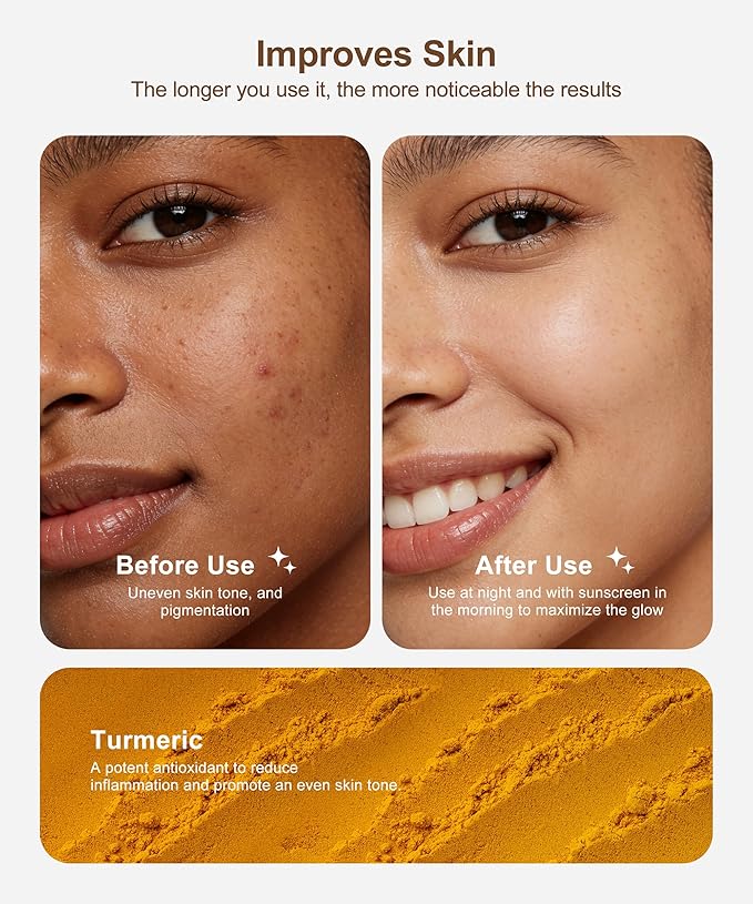Lemon Turmeric Kojic Acid Soap, 4 Pcs Turmeric Soap Bar Infused with Hyaluronic Acid, Vitamin C，E, Shea Butter for Face & Body Deeply Clean, 3 Foam Nets
