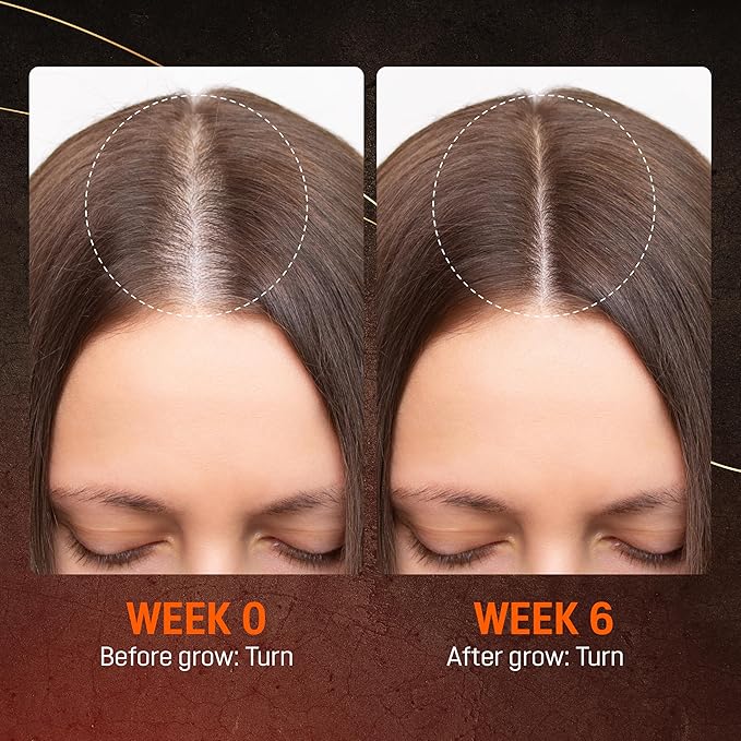 Abera Hair Growth Serum - Natural Regrowth Treatment for Hair & Beard with Biotin & Castor Oil, Economy Combo (3 Serums + Gift)